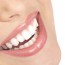 implantologia-dentale implantologia-dentale